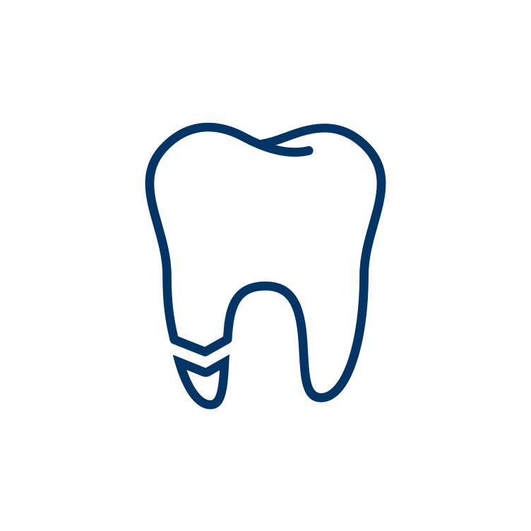 Dental Bondings