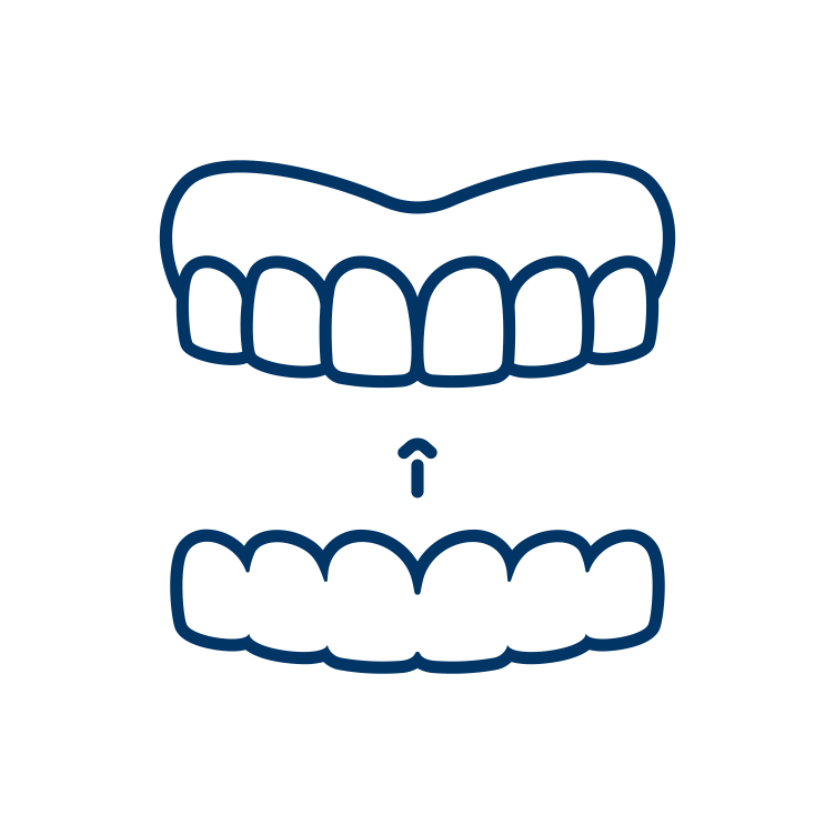 Clear Aligners